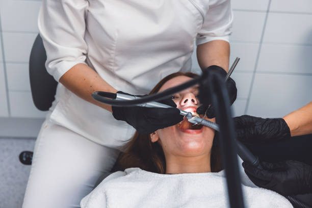 Best Emergency Wisdom Teeth Removal in Ottawa, IL